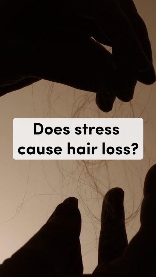 Does stress cause hair loss?