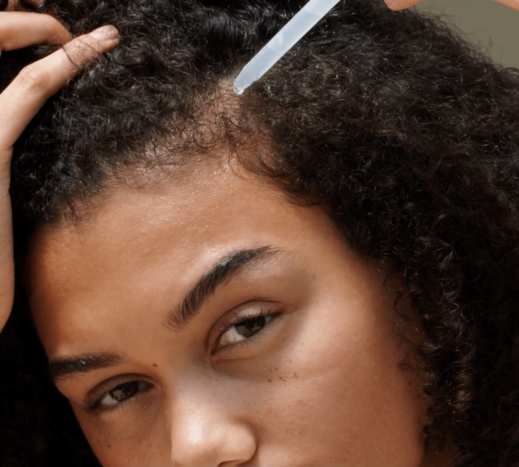 How to Prevent Hair Loss in Women